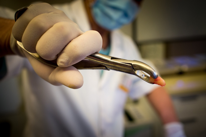 Are You Allowing This Dangerous Animal Dental Mistake?